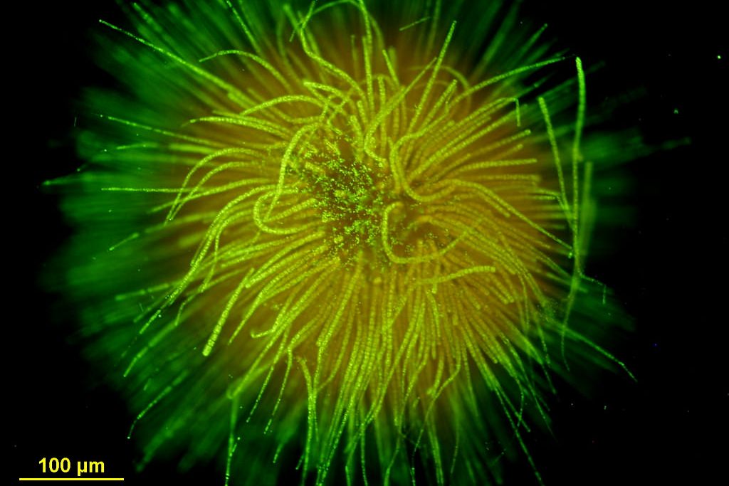 cyanobacterium called Gloeotrichia echinulata (Photo Credit: Dr. Barry Rosen, U.S. Geological Survey)