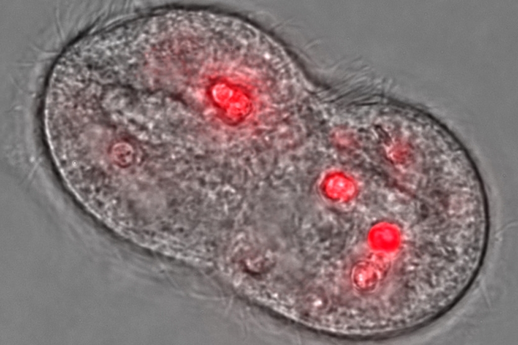 ciliate T. pyriformis [protozoan] (Photo Credit: National Institute of Standards and Technology)
