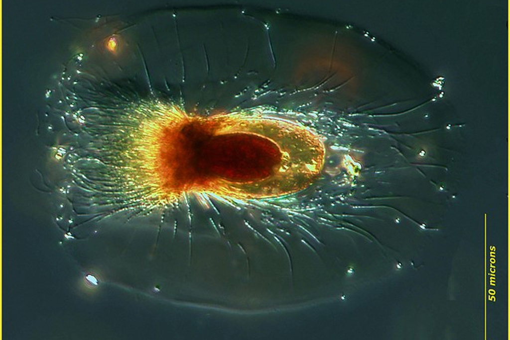 Unidentified plankton (Photo Credit: Dr. John R. Dolan, Laboratoire d'Oceanographique de Villefranche; Observatoire Oceanologique de Villefrance-sur-Mer)