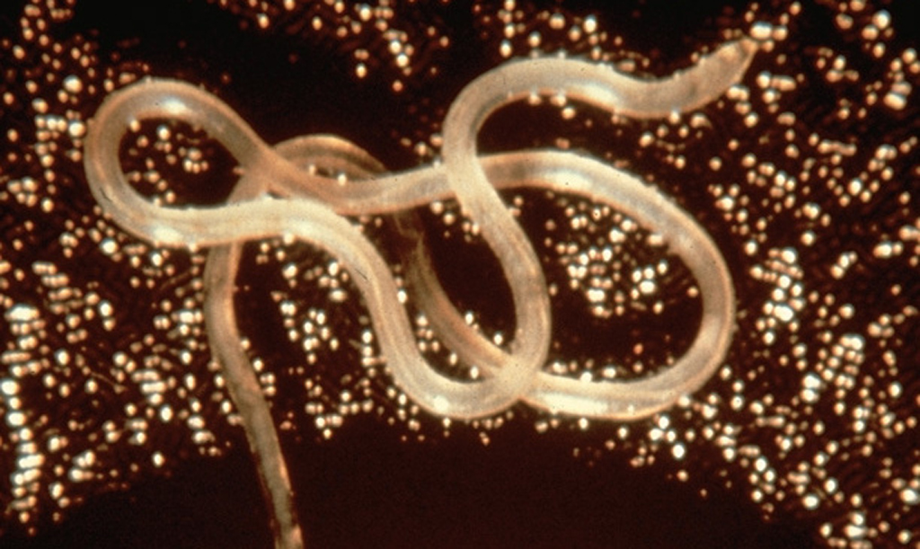 roundworm (Photo Credit: National Institute of Allergy and Infectious Diseases)