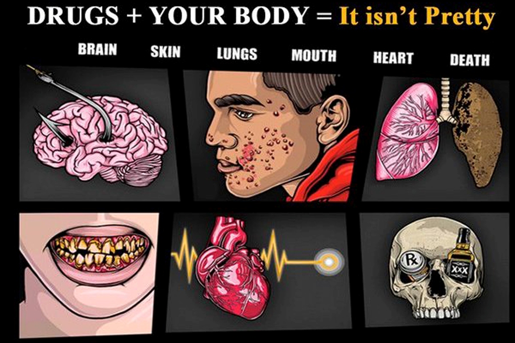 Destruction by humans (Photo Credit: National Institute on Drug Abuse/National Institutes of Health)